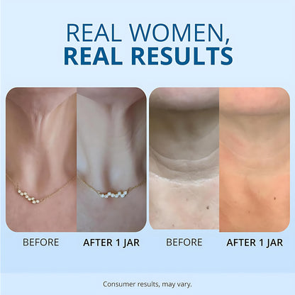 goPure Neck Cream Tighten & Lift FirmingCream for Crepey Skin TighteningCosmetic -Clinically Proven, Safe & Clean,Dermatologist Recommended, CrueltyFree